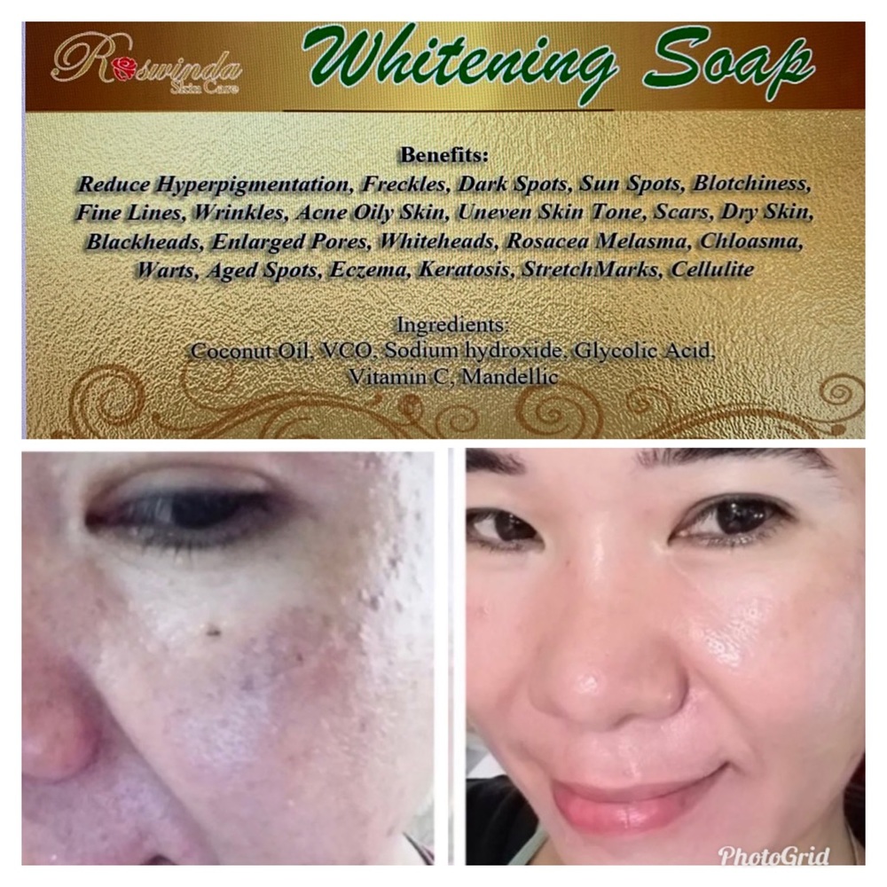 Whitening Soap Remove Dark Spot